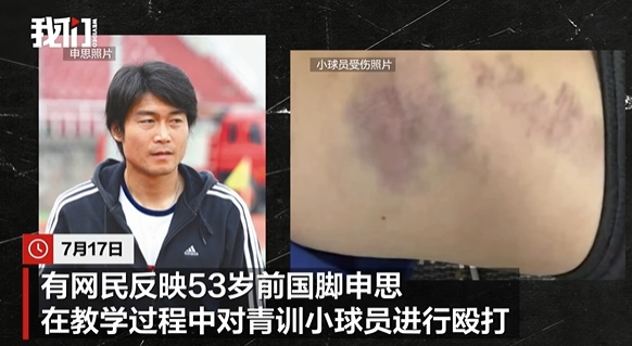 申思掌掴小球员后续：俱乐部称其顾问身份，家长已报警